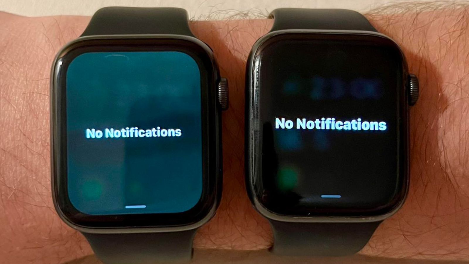 Latest watchOS 9.5 Update Could Turn Your Apple Watch Screen Green