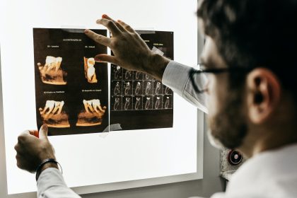Importance and Benefits of Digital Dental X-Rays